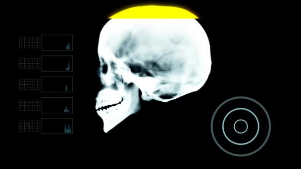 Профіль черепа під рентгенівським промінням з іншими елементами — стокове відео