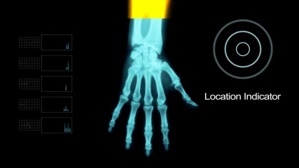 Perfil do braço em X-Ray com alguns outros elementos — Vídeo de Stock