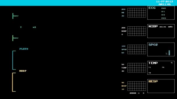 Özelleştirme için boş bir Akg EKG monitör — Stok video