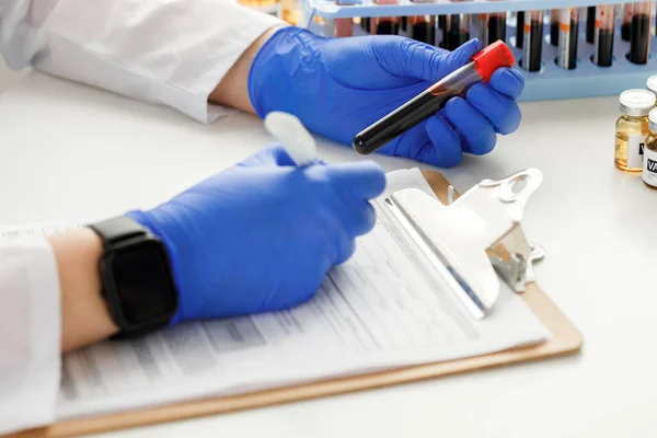 Mãos de um médico segurando amostra de sangue e fazendo anotações — Fotografia de Stock