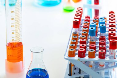 Kan örnekleriyle laboratuvar geçmişi ve kimyasallarla dolu cam eşyalar.