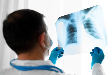 Doktor akciğerlerini muayene ediyor. Hastanedeki ofisinde röntgen taraması.