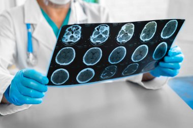 Hastanedeki masada otururken kafa MR 'ını inceleyen adam doktor.