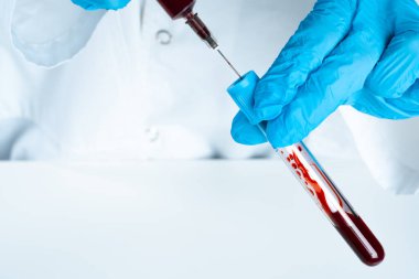 Mavi eldivenli doktor, elinde kan ve şırıngayla test tüpü tutuyor.