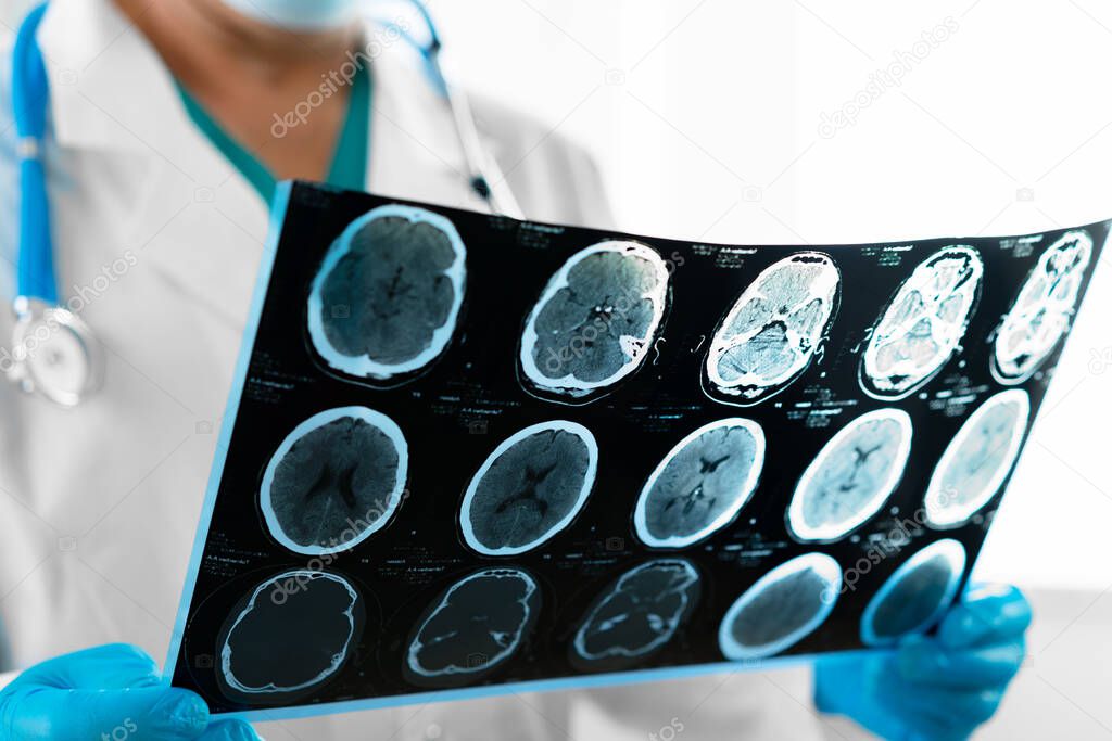 Hands of a doctor holding head mri scan