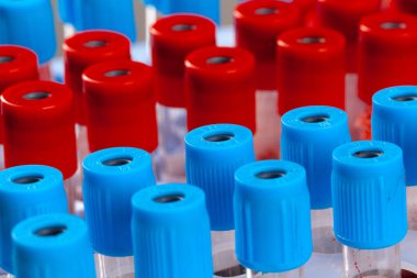 Analiz için kan testi tüpü. 2019-NCoV virüs enfeksiyonu Çin, Wuhan 'dan kaynaklanıyor.