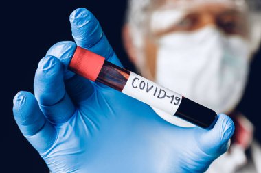 Enfekte olmuş kan örneği COVID 19, doktorun elinde bulunan örnek tüpte..