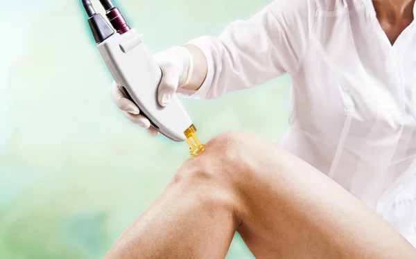 Lazer tüy ayıklama