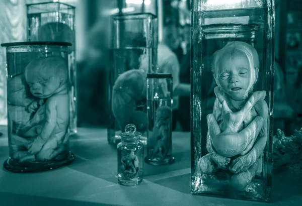 连在一起的双胞胎 俄罗斯圣彼得堡Kunstkamera博物馆的胚胎 突变体 — 图库照片