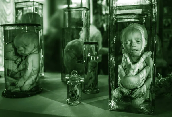Bliźniaczki Zarodki Mutanty Potwory Kunstcamera Museum Petersburg Rosja — Zdjęcie stockowe