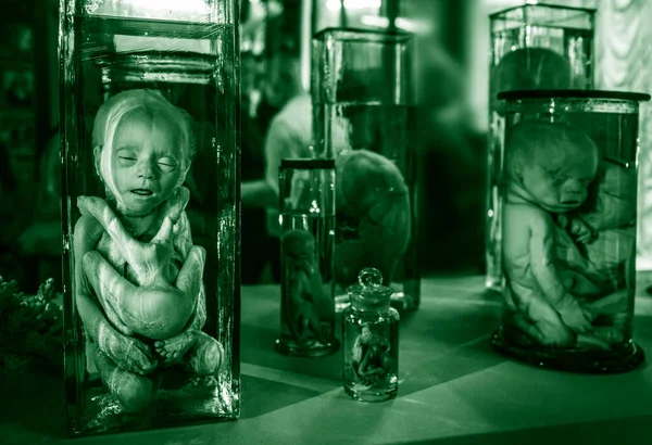 Verbonden Tweeling Embryo Mutanten Monsters Kunstkamera Museum Sint Petersburg Rusland — Stockfoto