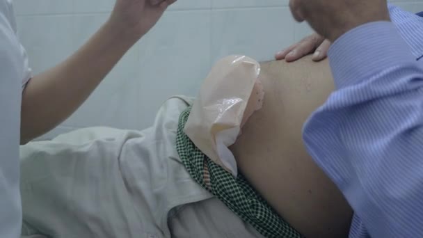 Ostomi Torbası Hastaların Bağırsaklarını Dinlendirmek Için Oldukça Basit Bir Alettir — Stok video