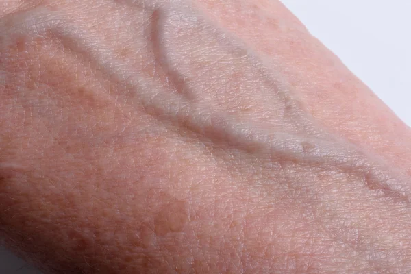 Veins on the wrist of an older woman — Stock Photo, Image
