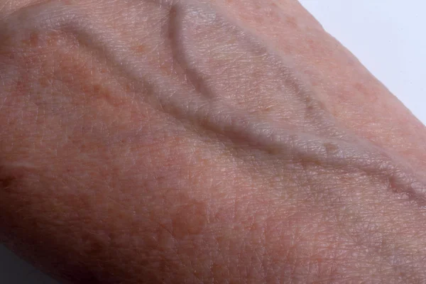 Detail of the veins in the arm of an elderly woman — Stock Photo, Image