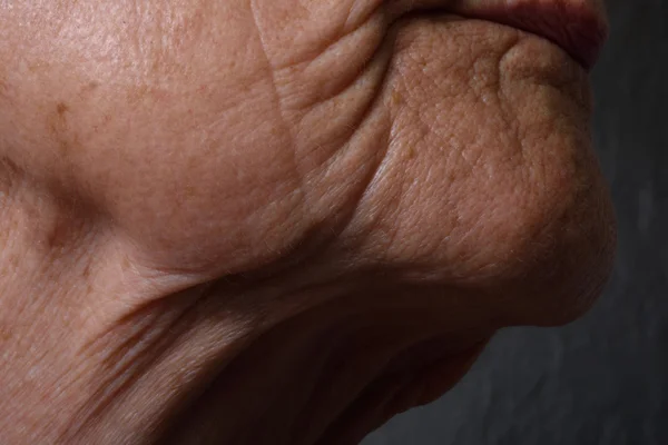 Arrugas en la barbilla y el cuello de una mujer mayor — Foto de Stock