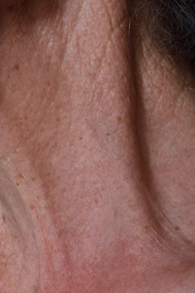 Rynkor på halsen av en äldre kvinna — Stockfoto