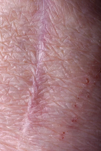 Cicatriz de joelho de uma mulher idosa — Fotografia de Stock