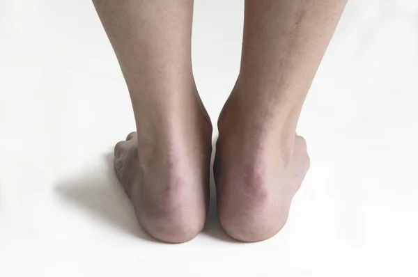 Fotografía de estudio de los pies de una mujer —  Fotos de Stock