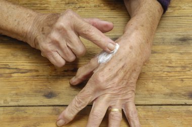 Yaşlı kadın üzerinde merhem koymak