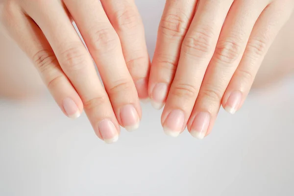 Closeup Beautiful Hands Fingernails Woman White Background Concept Health Care — Stock Photo, Image