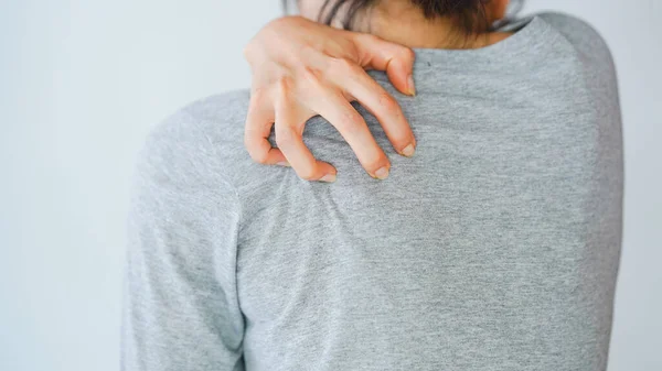 汗アレルギーによるかゆみの原因で背中を掻いている女性 皮膚病の概念 — ストック写真