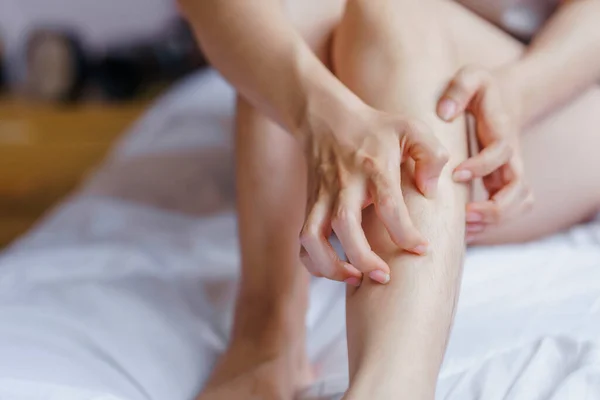 Kobieca Ręka Drapiąca Nogę Łóżku Powodu Reakcji Alergicznej — Zdjęcie stockowe