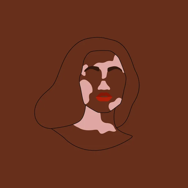 Portrait Abstrait Femme Avec Peau Vitiligo Vector Flat Line Art — Image vectorielle