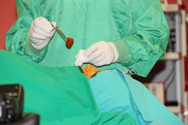 Equipe de Cirurgia Plástica operando em uma sala cirúrgica — Fotografia de Stock