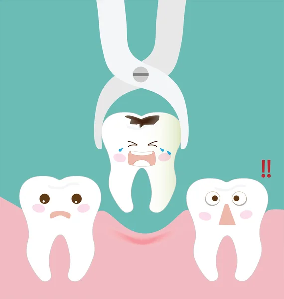 Pinça de extração dentária e dente —  Vetores de Stock