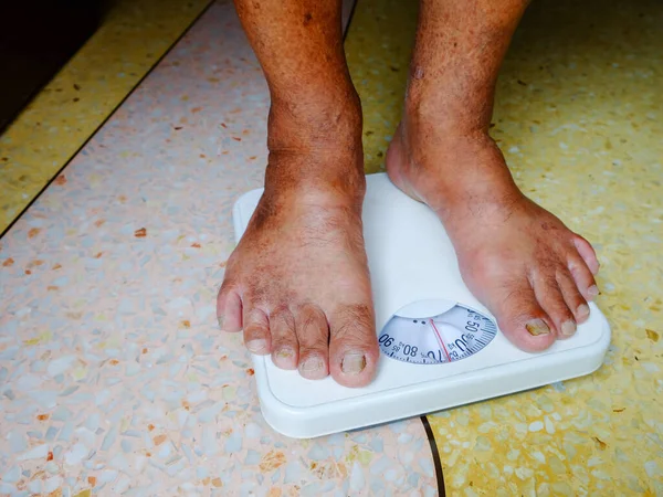 Foot of  aged man standing on weight scale