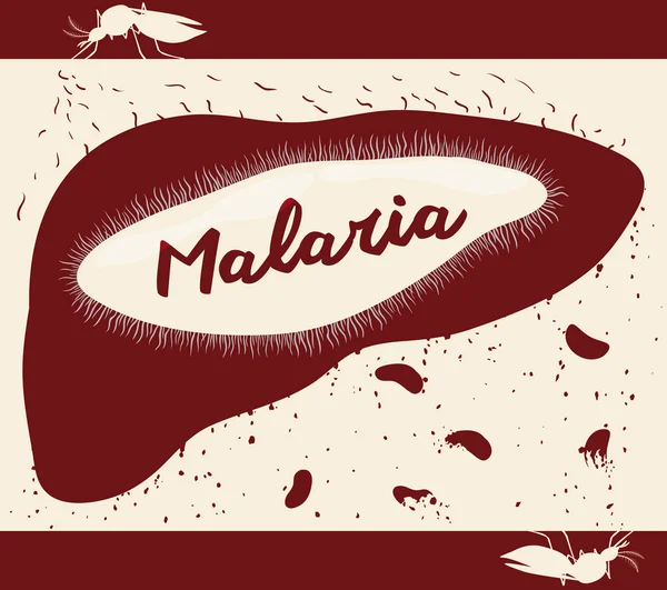 Lebenszyklus von Malariaplasmodium im menschlichen Körper, Vektorillustration — Stockvektor