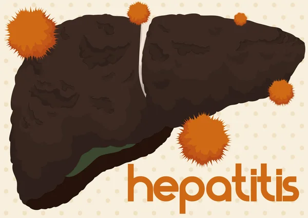 Hígado bajo ataque por el virus de la hepatitis, ilustración vectorial — Vector de stock