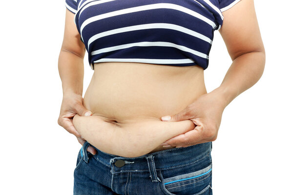 abdominal surface of fat woman 