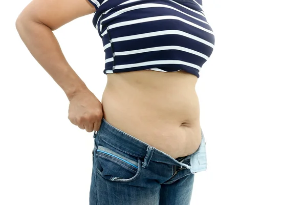 Abdominale oppervlak van dikke vrouw — Stockfoto