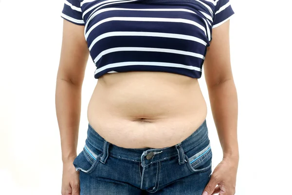 Superficie addominale della donna grassa — Foto Stock