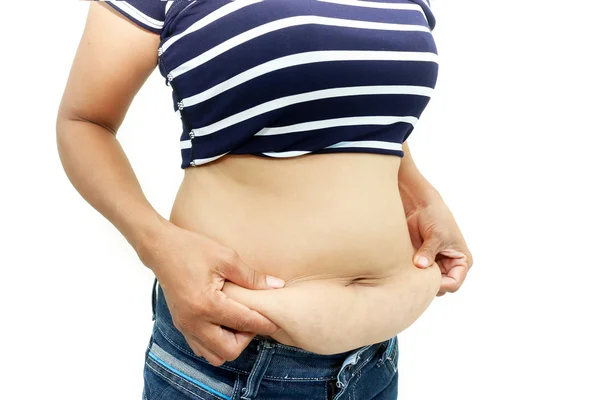 Surface abdominale de la grosse femme — Photo