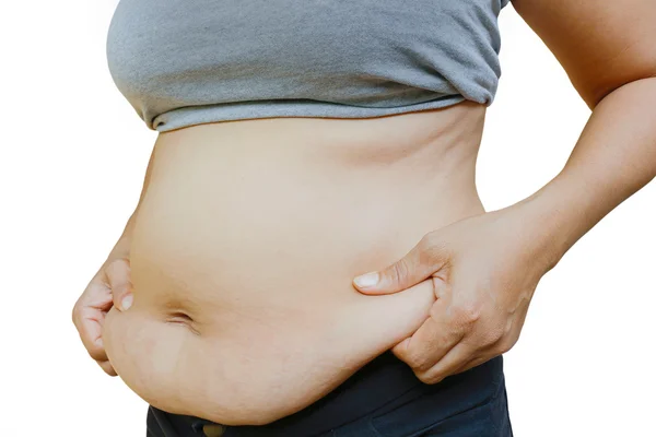 Mujeres con grasa — Foto de Stock