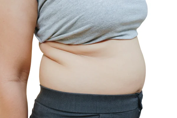 Women with fat — Stock Photo, Image