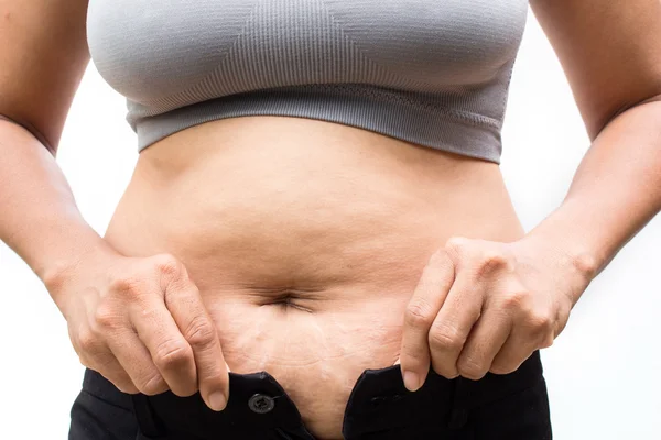 Mujer gorda — Foto de Stock