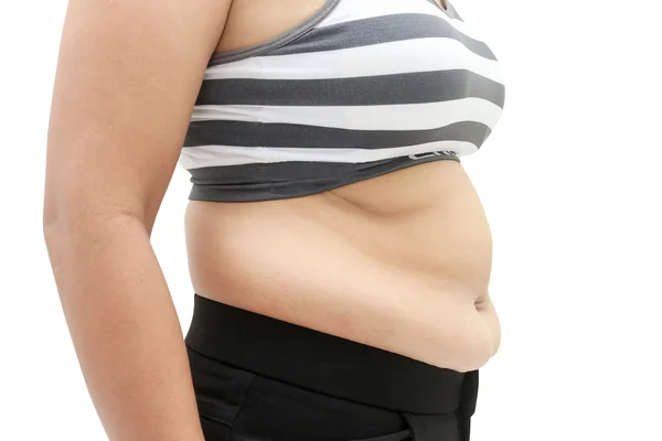 Fett och celluliter. — Stockfoto