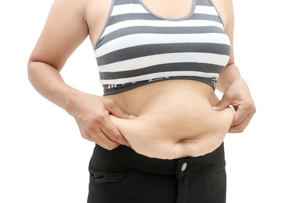 Fat and cellulite. — Stock Photo, Image