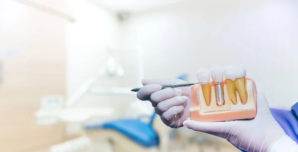 Odontologia Saúde Modelo Dentes Para Dentista Para Trabalhar Clínica Odontológica — Fotografia de Stock