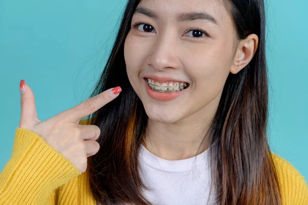 Wanita Asia Tersenyum Mengenakan Ortodontik Pengikut Latar Belakang Layar Biru — Stok Foto