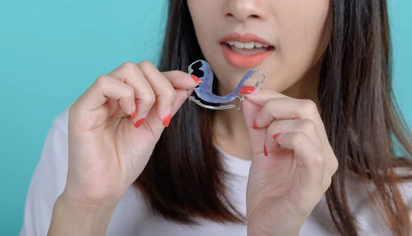 Smiling Asian Woman Holding Orthodontic Retainer Blue Screen Background Perawatan — Stok Foto