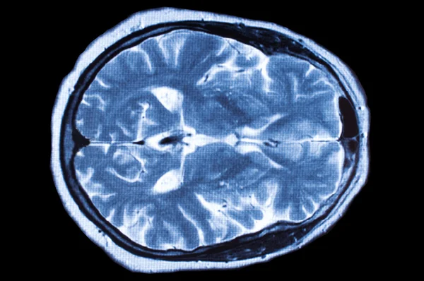 x-ray görüntü beyin bilgisayarlı tomografi