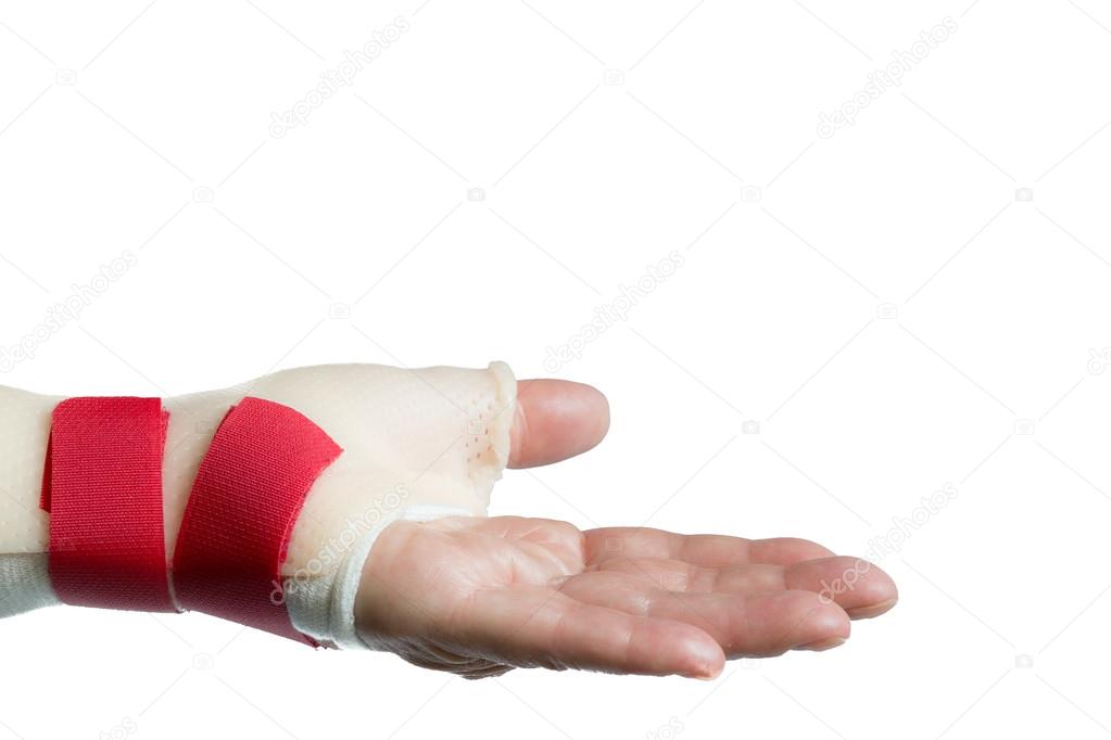 Hand with wrist and thumb splint