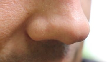 Erkek burun nefes anatomisi