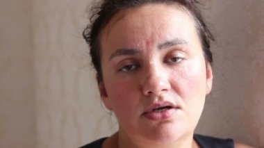 Sıcaktan acı kadın