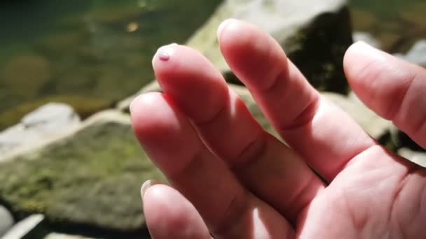 Wound, female fingers wounded pov, amateur video shot on mobile phone — Wideo stockowe