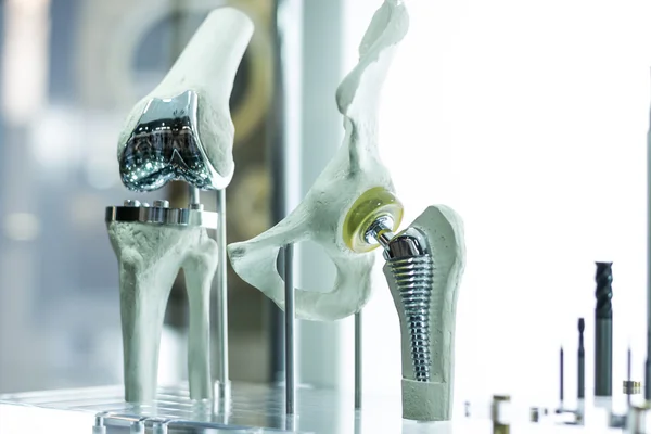 Knee and hip prosthesis for medicine — Stock Photo, Image